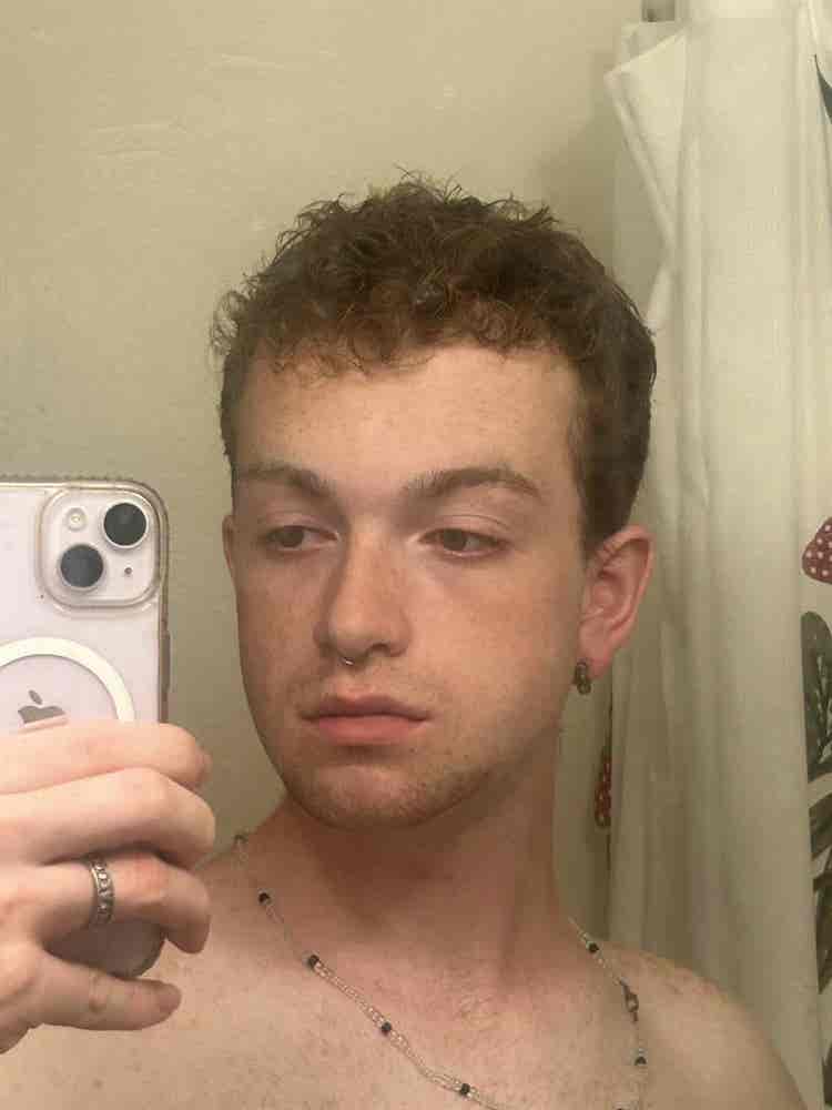 Anthony