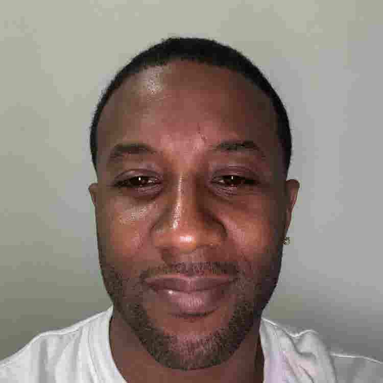 Hi I’m a black male  years of age