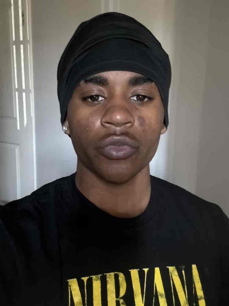 Anthony