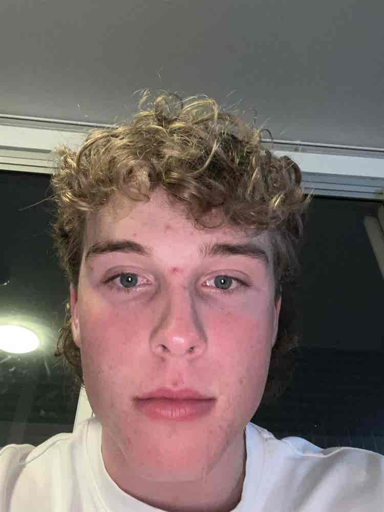 Zac