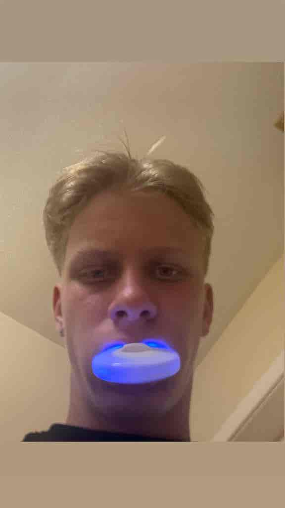 Ignas