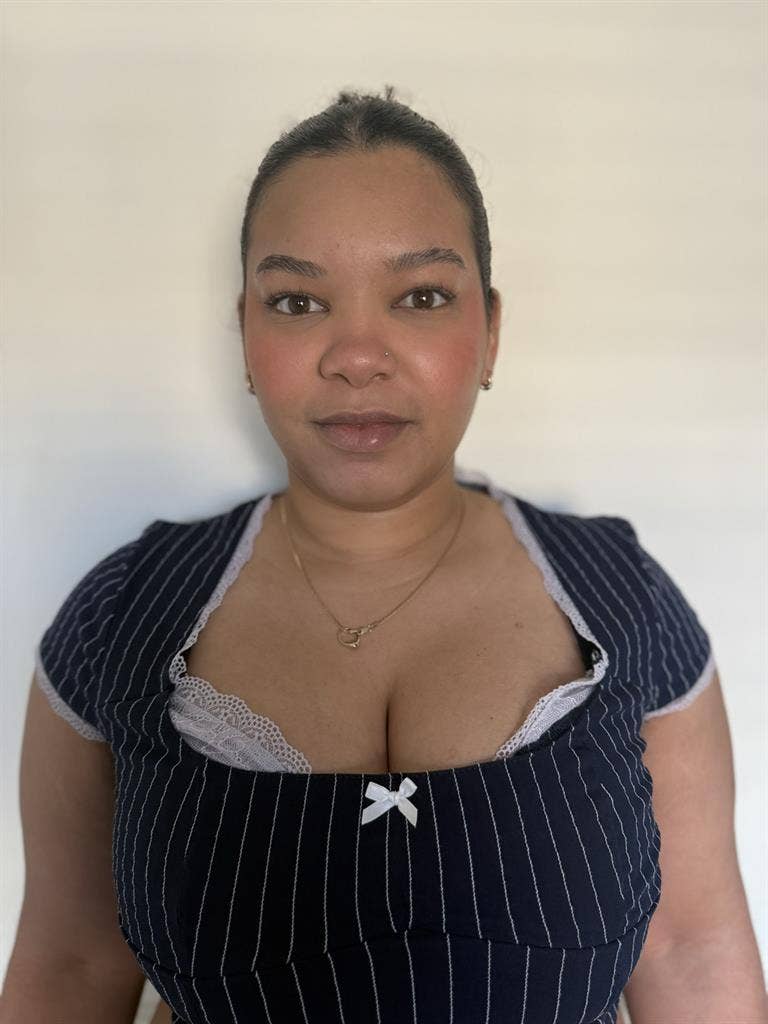 29 yo female with bulldog