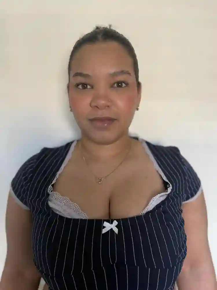 29 yo female with bulldog
