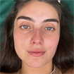 Nicolle