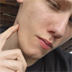 gunnar