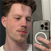 Jonas