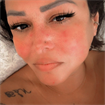 Zuleima